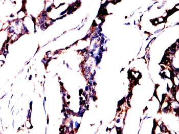 CAMK2A Antibody