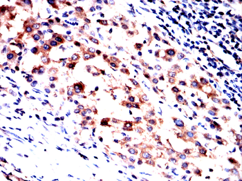 CAMK2A Antibody