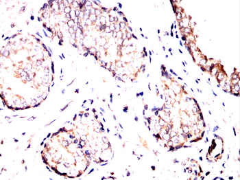 CAMK2A Antibody