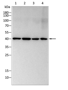 CAMK2A Antibody