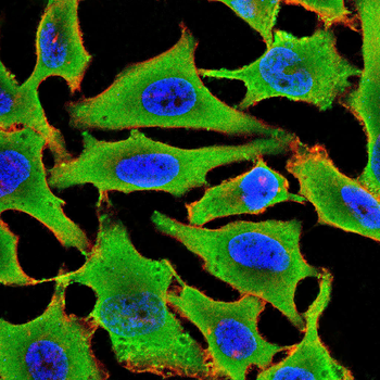 CAMK2A Antibody