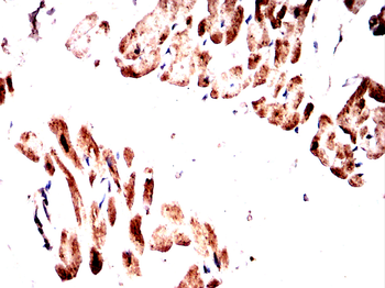 CAMK2A Antibody
