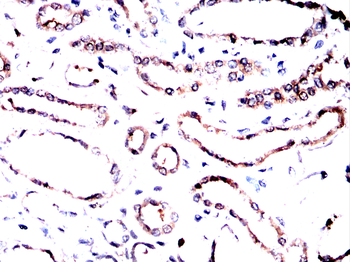 CAMK2A Antibody
