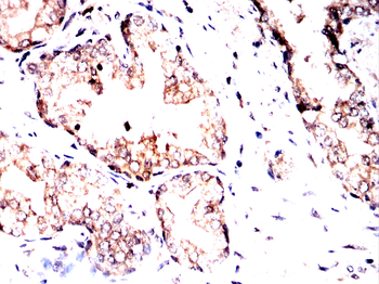 CAMK2A Antibody