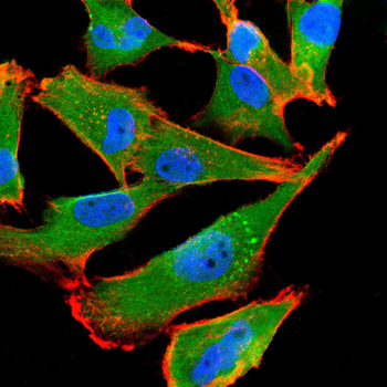 CALCA Antibody