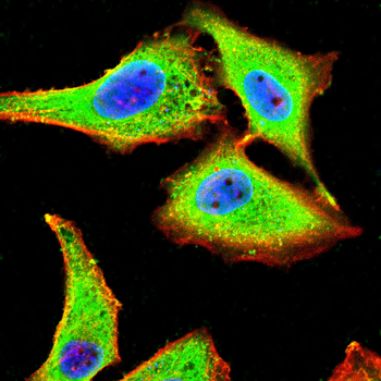 CALCA Antibody
