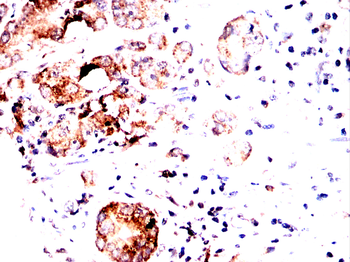 CALCA Antibody