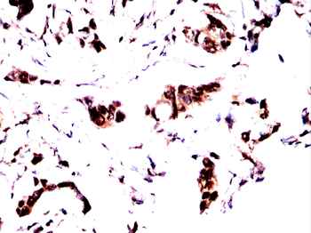 ESR1 Antibody
