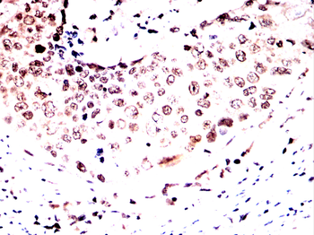 ESR1 Antibody
