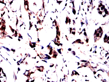 ESR1 Antibody