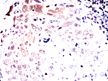 ESR1 Antibody