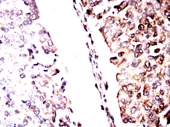 OGT Antibody
