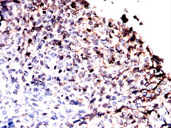 OGT Antibody