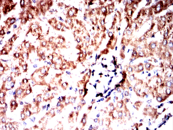 LCN2 Antibody