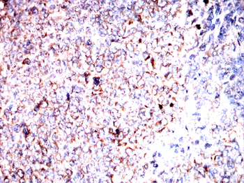 LCN2 Antibody