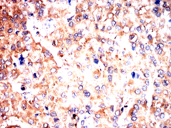 LCN2 Antibody