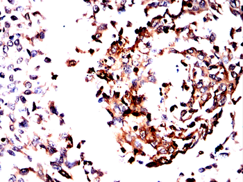 LCN2 Antibody