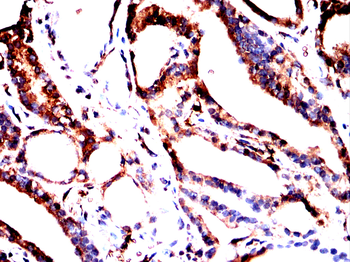 LCN2 Antibody