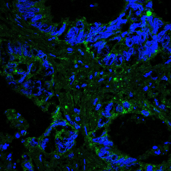 KDR Antibody