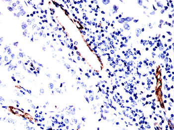 KDR Antibody
