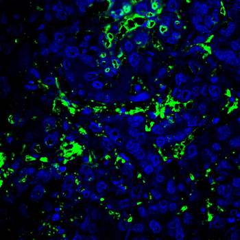 KDR Antibody