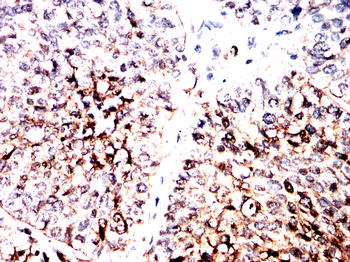 NF2 Antibody