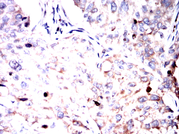 NF2 Antibody