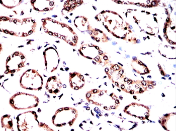 NF2 Antibody