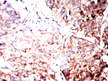 NF2 Antibody