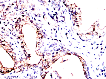 NOTCH3 Antibody