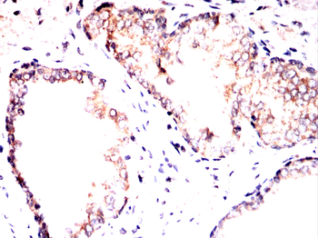 NOTCH3 Antibody