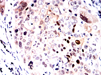 HDAC4 Antibody