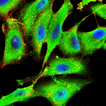 PRDM1 Antibody