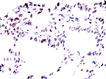 PRDM1 Antibody