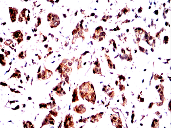 PRDM1 Antibody
