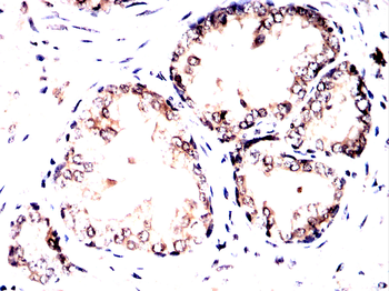 PRDM1 Antibody
