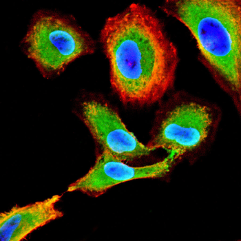 PRDM1 Antibody