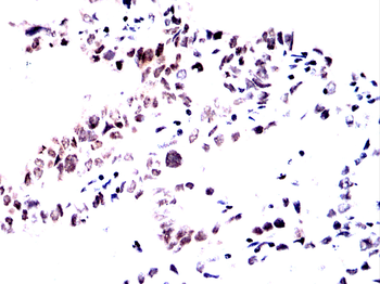 PRDM1 Antibody