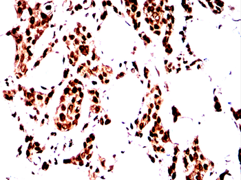 PRDM1 Antibody