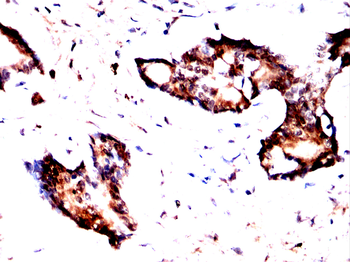 PRDM1 Antibody