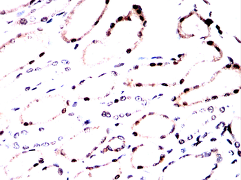 PRDM1 Antibody