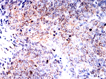 BMP7 Antibody