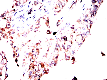 RAB3A Antibody
