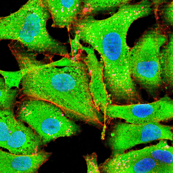 FABP1 Antibody