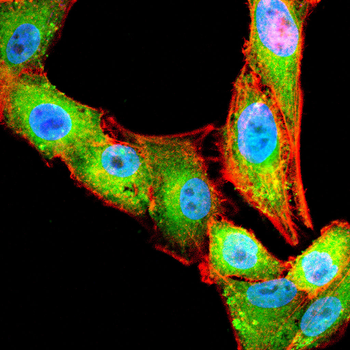 FABP1 Antibody