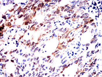 FABP1 Antibody