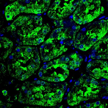 FABP1 Antibody