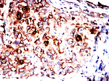 FABP1 Antibody