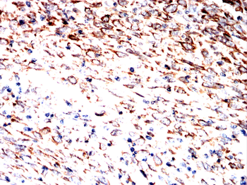 FABP1 Antibody