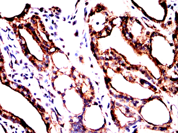 FABP1 Antibody